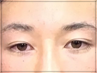 吉田輝星の目が茶色い＆まつ毛が長いハーフ顔画像